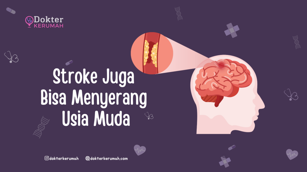 Stroke Juga Bisa Menyerang Usia Muda